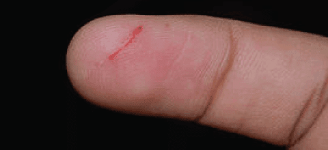 Small Incident, Blog Feature